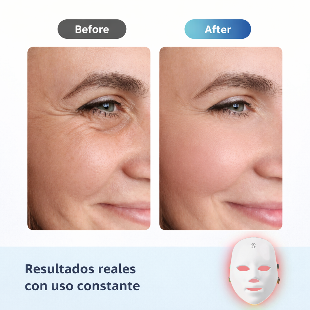 EternaGlow™ Máscara LED Anti-Edad [Piel Joven, Lisa y Radiante]